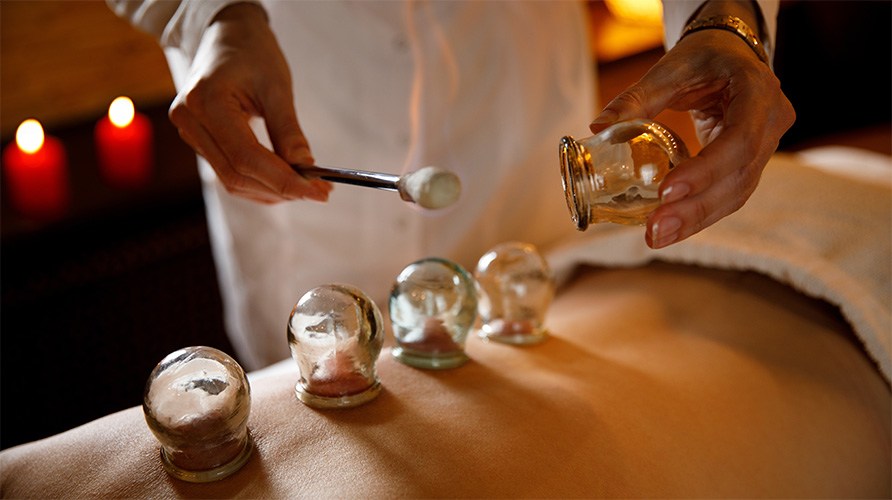 Koppningsbehandling med glaskoppar p� ryggen.